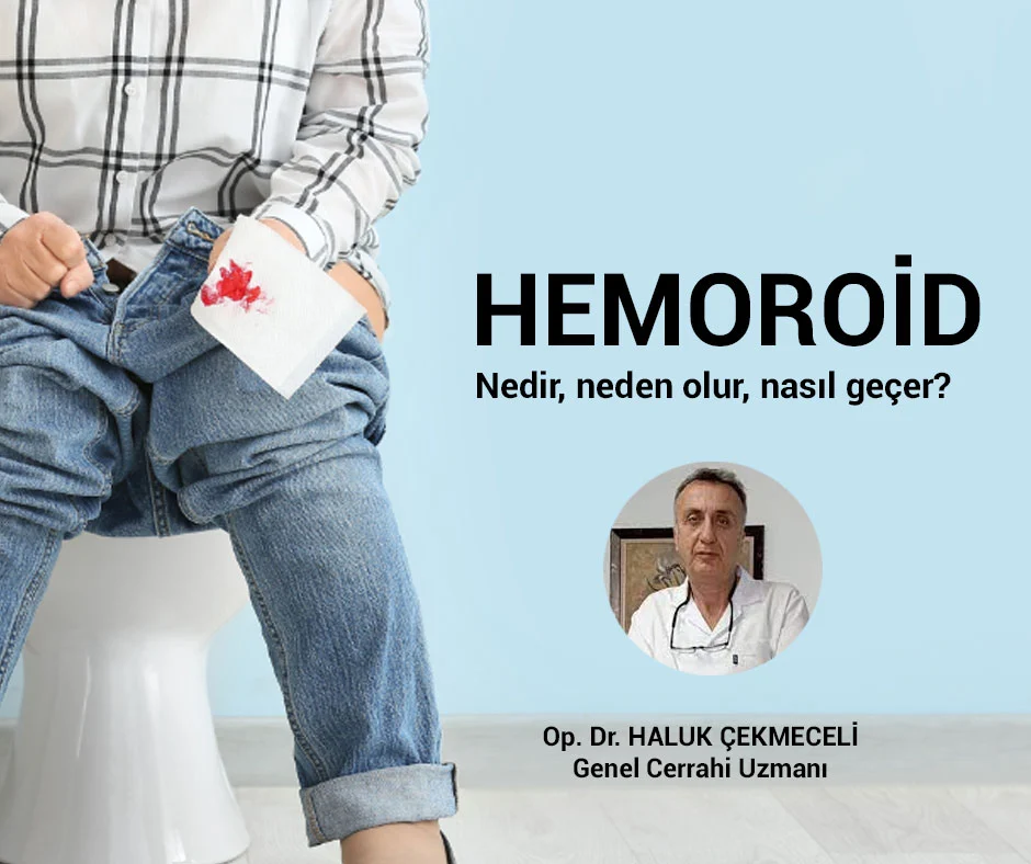 Hemoroid tedavisi